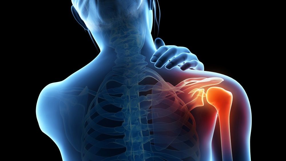 Natural Remedies for Effective Joint Injury